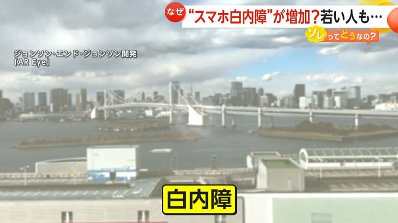 白くかすんだようになる白内障の見え方