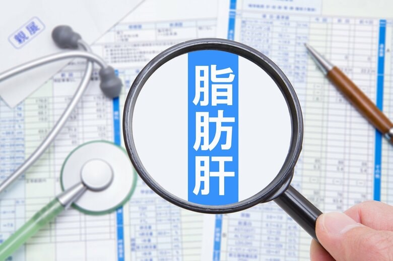 多くの人に誤って受け止められている脂肪肝（画像：イメージ）