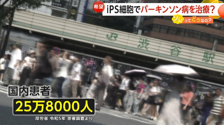 日本国内には25万8000人の患者がいるとされるパーキンソン病