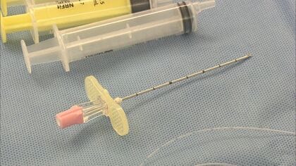 様々な“合併症リスク”も存在…広がる『無痛分娩』への費用補助 産婦人科医に聞いたメリットとデメリット