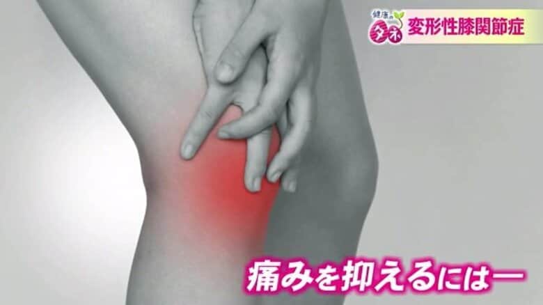 自覚症状ない患者は3000万人　高齢者だけじゃない！「変形性膝関節症」　“運動のし過ぎ”や体重の急増は要注意｜FNNプライムオンライン