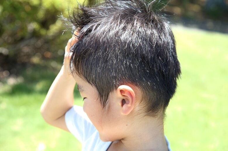 子供が頭をかいていたら頭髪の確認を（画像：イメージ）