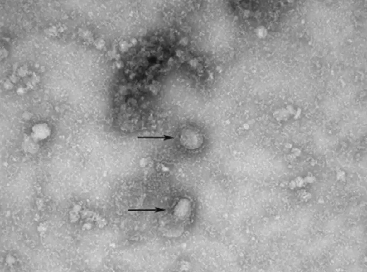 天然 痘 で 滅亡 した 国家