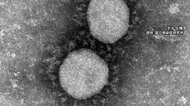 全国の感染者 2日連続で1万人超える 死亡は9人