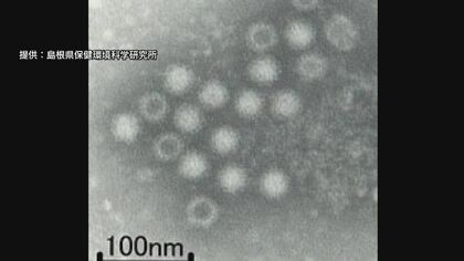 「わずかな量でも感染…」急増するノロウイルスによる食中毒「アルコール消毒は効果薄」対策の難しさ浮き彫り