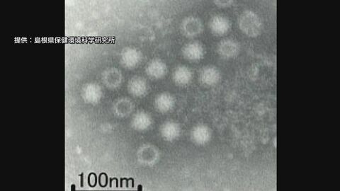 わずかな量でも感染ノロウイルスによる食中毒「アルコール消毒は効果薄」対策の難しさ【2025ピックアップ】