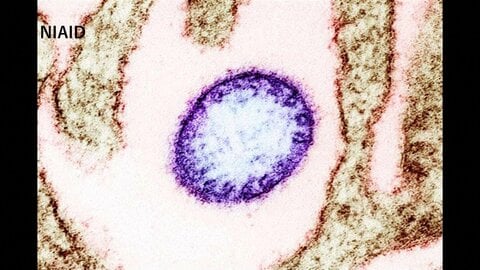 “致死率40～75％”ニパウイルス感染者2人をインド東部で確認　周辺国は水際対策を強化　