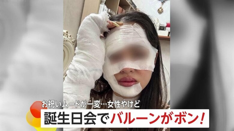 誕生日会で風船が“爆発”主役の女性が大やけど…包帯でグルグル巻きに　使われたのは燃えやすい“水素”　ベトナム｜FNNプライムオンライン