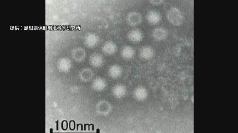 「わずかな量でも感染…」急増するノロウイルスによる食中毒「アルコール消毒は効果薄」対策の難しさ浮き彫り｜FNNプライムオンライン