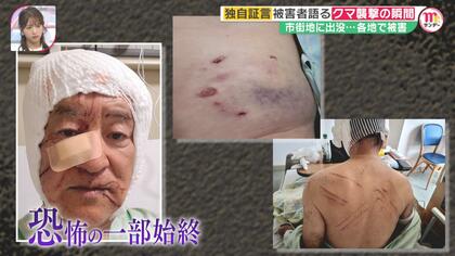 【独自】「コォーって声出してかじってる」取材直後クマに…顔と頭に大ケガ負った被害者語る襲撃の瞬間