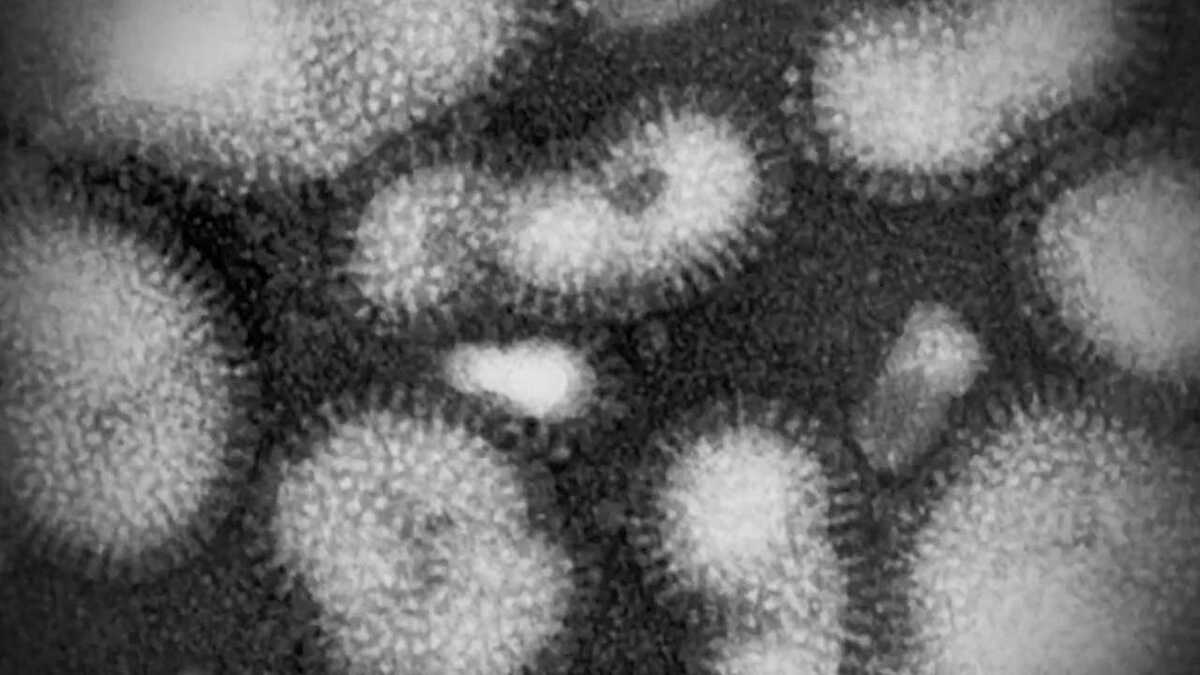 2割が 完治前に出勤 その背景に インフルエンザ ハラスメント か Fnnプライムオンライン