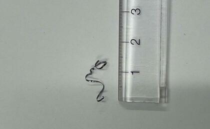 尾道市因島の特別支援学校　給食に「金たわしの一部のようなもの」混入　健康被害の報告なし　広島