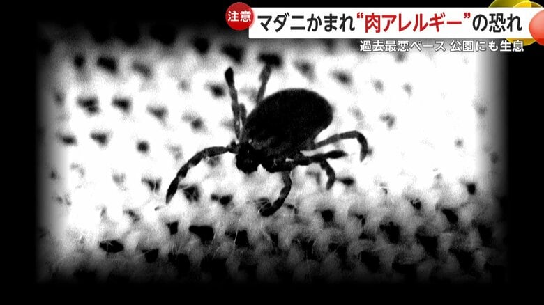 マダニ感染症が増加“肉アレルギー”を発症するケースも　ダニ専門家に「休みの日」の注意点を聞いた｜FNNプライムオンライン
