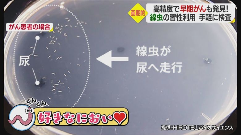 がん患者の尿に集まる線虫
