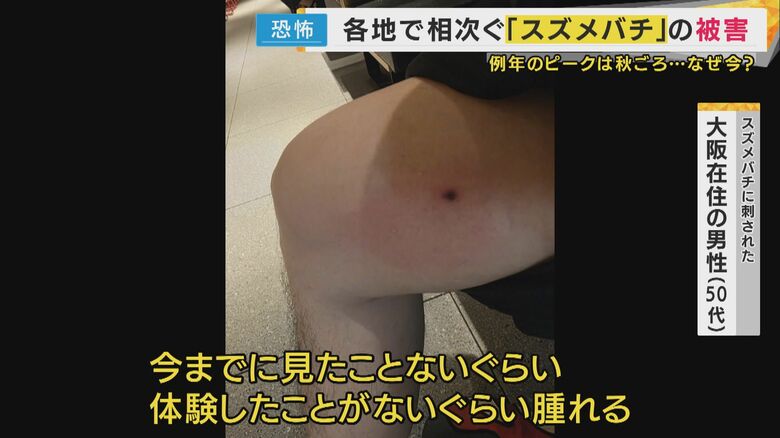 スズメバチに刺された大阪居住の男性