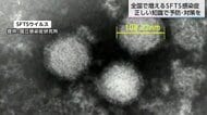 庭先で…ペットから…　致死率30%・マダニが媒介する感染症「SFTS」が全国で猛威　宮崎県では死亡事例が発生