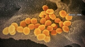 新型コロナ 東京都で新たに350人の感染確認【2月16日】