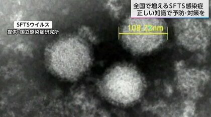 庭先で…ペットから…　致死率30%・マダニが媒介する感染症「SFTS」が全国で猛威　宮崎県では死亡事例が発生
