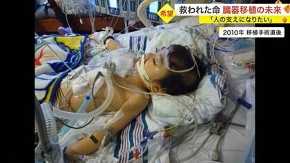心臓移植しか助かる道がない」臓器移植法施行25年 “海外頼み”増え