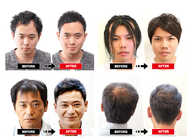 最新 薄毛 髪型 女性 20代 トレンディなヘアスタイル