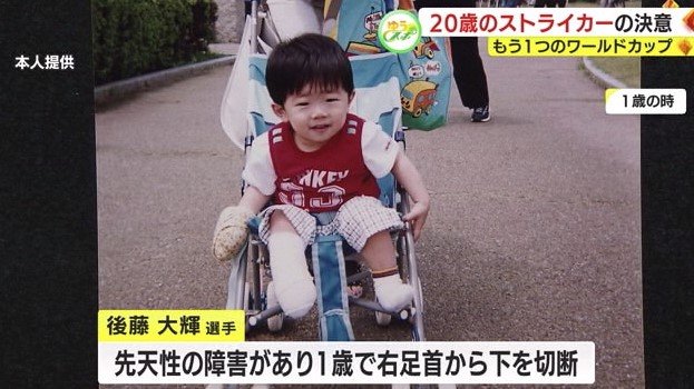 後藤さんは1歳で右足首から下を切断