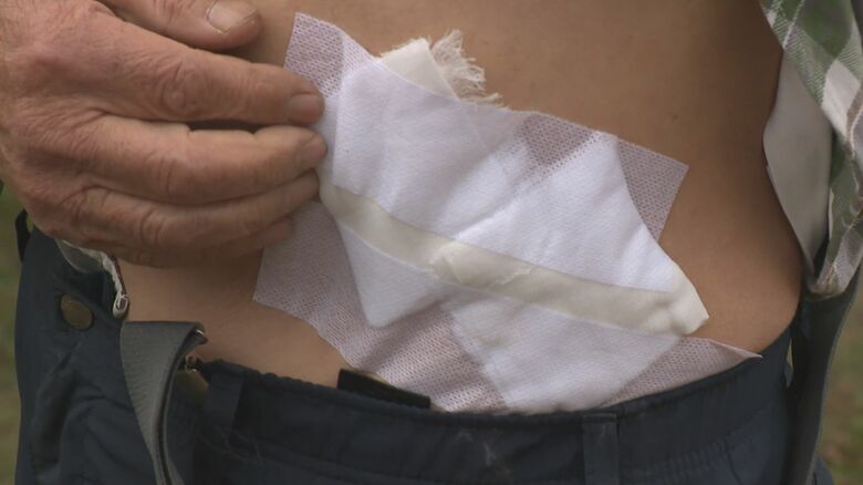 ツメでひっかかれ負傷