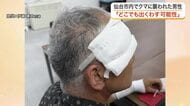 「クマだと思った瞬間、倒された」仙台市で今年初の人身被害　顔や手に傷痕残る男性が当時の恐怖を語る