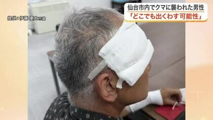 「クマだと思った瞬間、倒された」仙台市で今年初の人身被害　顔や手に傷痕残る男性が当時の恐怖を語る