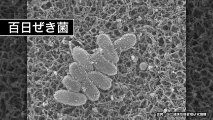 【百日ぜき 全国で流行】長くせきが続く『百日ぜき』が流行中 乳児は重症化し死に至ることも 北海道内では2025年で162人が感染 子どもだけでなく大人もしっかり予防を