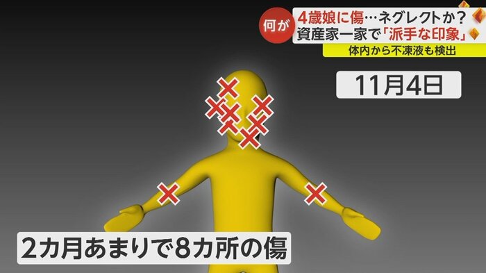 亡くなる前年の2022年9月、通っていた保育園から美輝ちゃんの頬・両腕にひっかき傷があったと報告