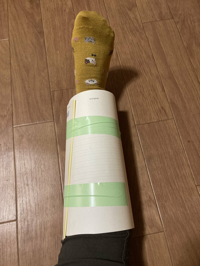 骨折の固定にも