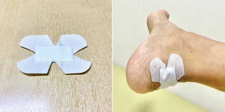 アキレス腱に貼る場合（提供：湘南鎌倉総合病院）