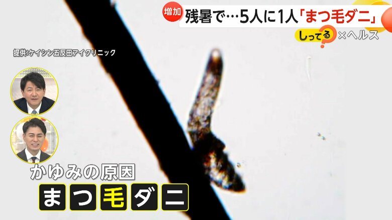 顕微鏡で見たまつ毛ダニ