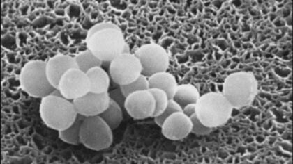 1週間前の授業で種菌を投入…中学校で教師の自家製ヨーグルト食べた5人が腹痛や嘔吐【愛知発】