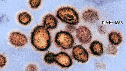 ワクチン2回接種も「ブレイクスルー感染」“ワクチンは効果なし”とのデマも…国立感染症研究所は異例の反論