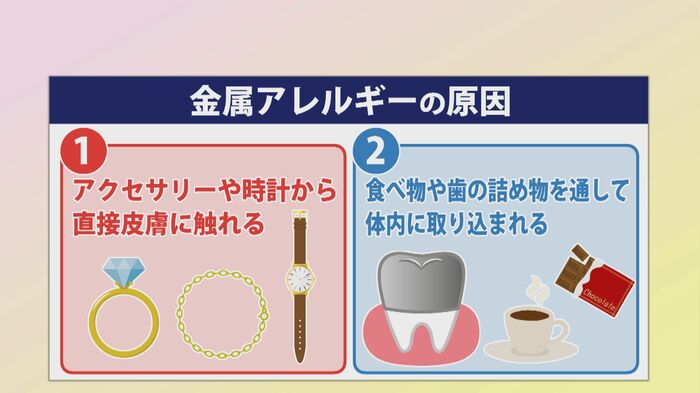 原因は大きく2つ
