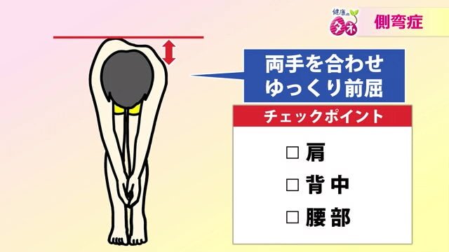 側弯症のチェック方法