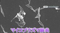【大流行】マイコプラズマ肺炎東京で“最多”に…最大の特徴「乾いたせき」ってどんなせき? 対策は?
