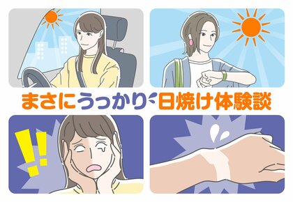 まさに“うっかり”な日焼け体験談続々|夏に選びたいスキンケアの特徴も【うっかり日焼けに関する調査報告】