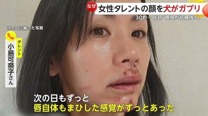 しびれた感じが続いたという