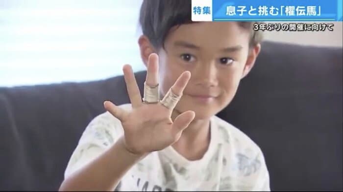 練習を重ねた指を見せる海月くん
