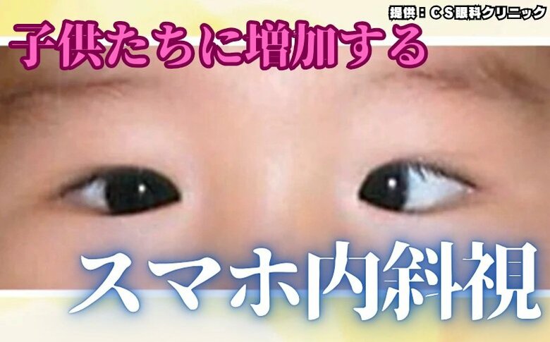 子供たちに増加する「スマホ内斜視」完治しないケースも　デジタルネイティブ世代を襲う目への悪影響　原因と予防法は｜FNNプライムオンライン