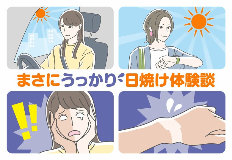 まさに“うっかり”な日焼け体験談続々|夏に選びたいスキンケアの特徴も【うっかり日焼けに関する調査報告】
