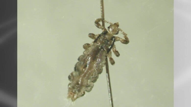 アタマジラミは体長2～4mmほど