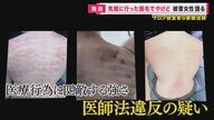 脱毛トラブル…「こんな業者はダメ！」消費者問題に詳しい弁護士が解説　脱毛は若者だけではない…中高年に人気の「介護脱毛」も
