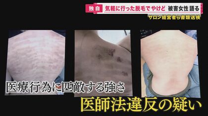 脱毛トラブル…「こんな業者はダメ！」消費者問題に詳しい弁護士が解説　脱毛は若者だけではない…中高年に人気の「介護脱毛」も