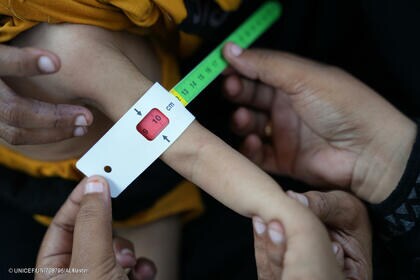 世界最悪の人道危機の一つ 紛争10年のイエメン 5歳未満児の半数が急性栄養不良 【プレスリリース】