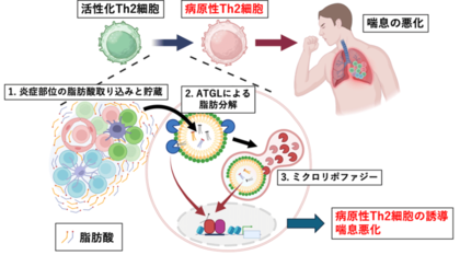 喘息などのアレルギー疾患が悪化するメカニズムを解明～脂肪分解経路を標的とした新たなアレルギー治療薬の開発に向けて