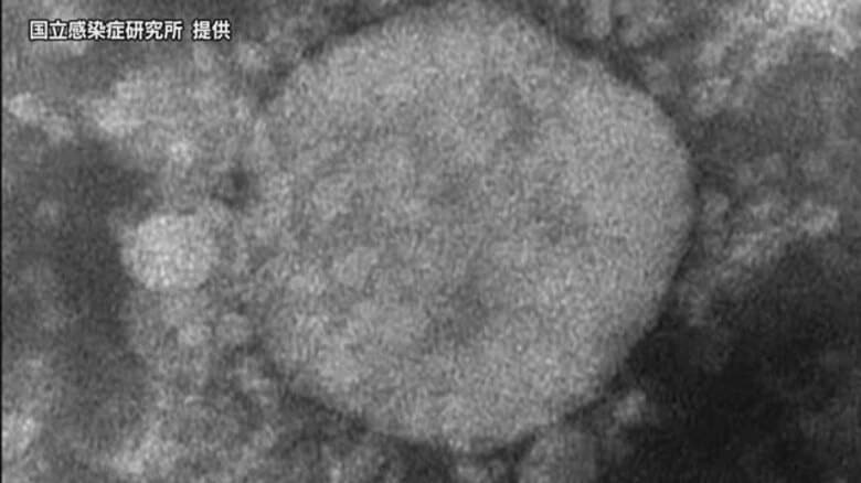 愛媛で新型コロナの感染増加　病原体検査で「ニンバス」が仲間の変異株検出　注意報レベル続く【愛媛】｜FNNプライムオンライン