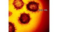 北海道5人死亡 157人感染…1月以来2日連続150人超